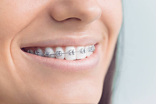 Best Traditional Braces  in Malad City, ID